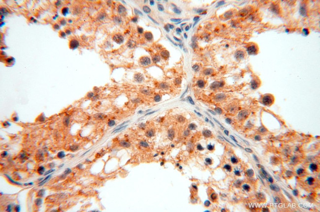 GTDC1 Antibody in Immunohistochemistry (Paraffin) (IHC (P))