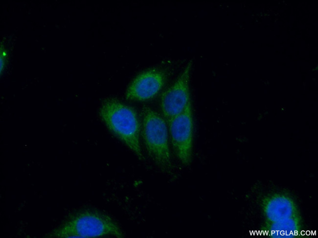 CD40L/CD154 Antibody in Immunocytochemistry (ICC/IF)