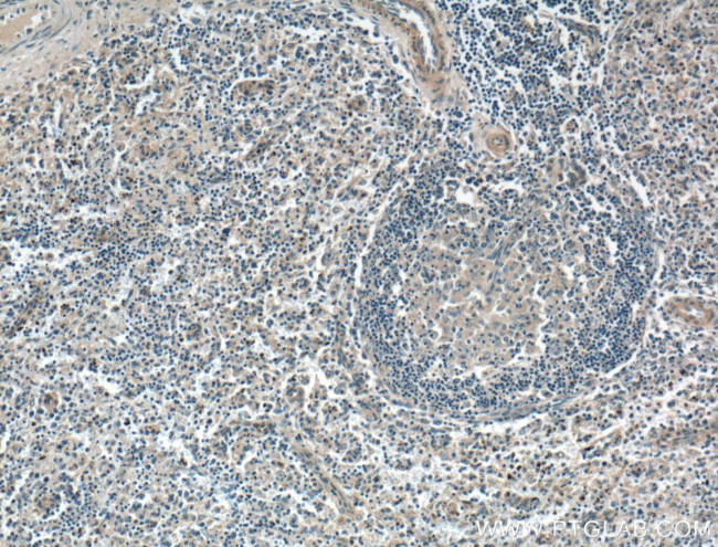 CD40L/CD154 Antibody in Immunohistochemistry (Paraffin) (IHC (P))