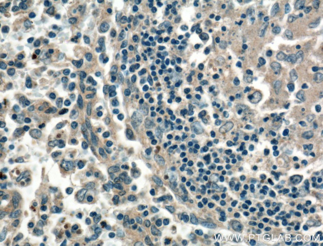 CD40L/CD154 Antibody in Immunohistochemistry (Paraffin) (IHC (P))