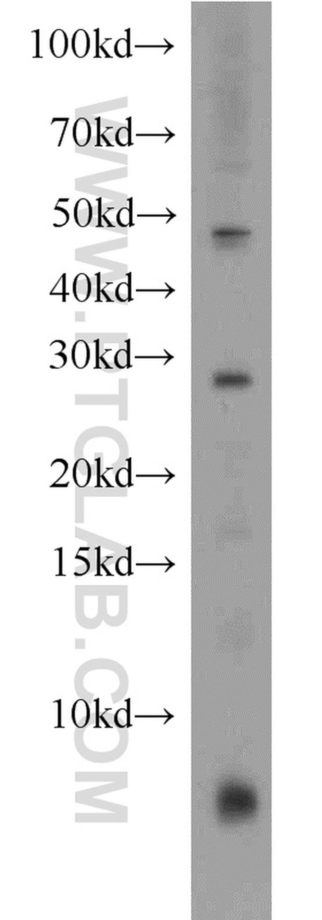 CD40L/CD154 Antibody in Western Blot (WB)