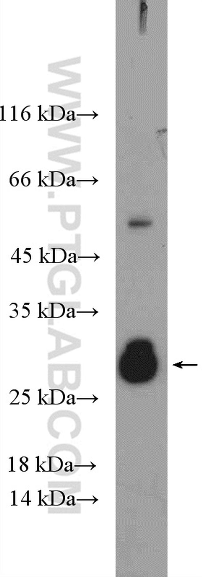 CD40L/CD154 Antibody in Western Blot (WB)