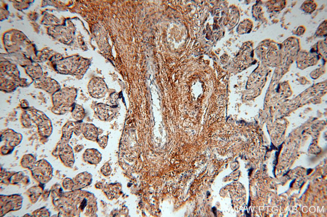 HPSE Antibody in Immunohistochemistry (Paraffin) (IHC (P))