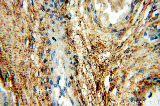 HPSE Antibody in Immunohistochemistry (Paraffin) (IHC (P))