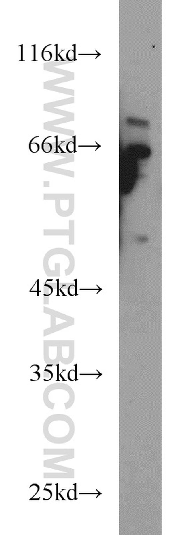 HPSE Antibody in Western Blot (WB)