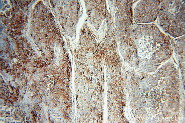 HPSE Antibody in Immunohistochemistry (Paraffin) (IHC (P))