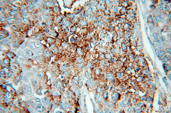 HPSE Antibody in Immunohistochemistry (Paraffin) (IHC (P))