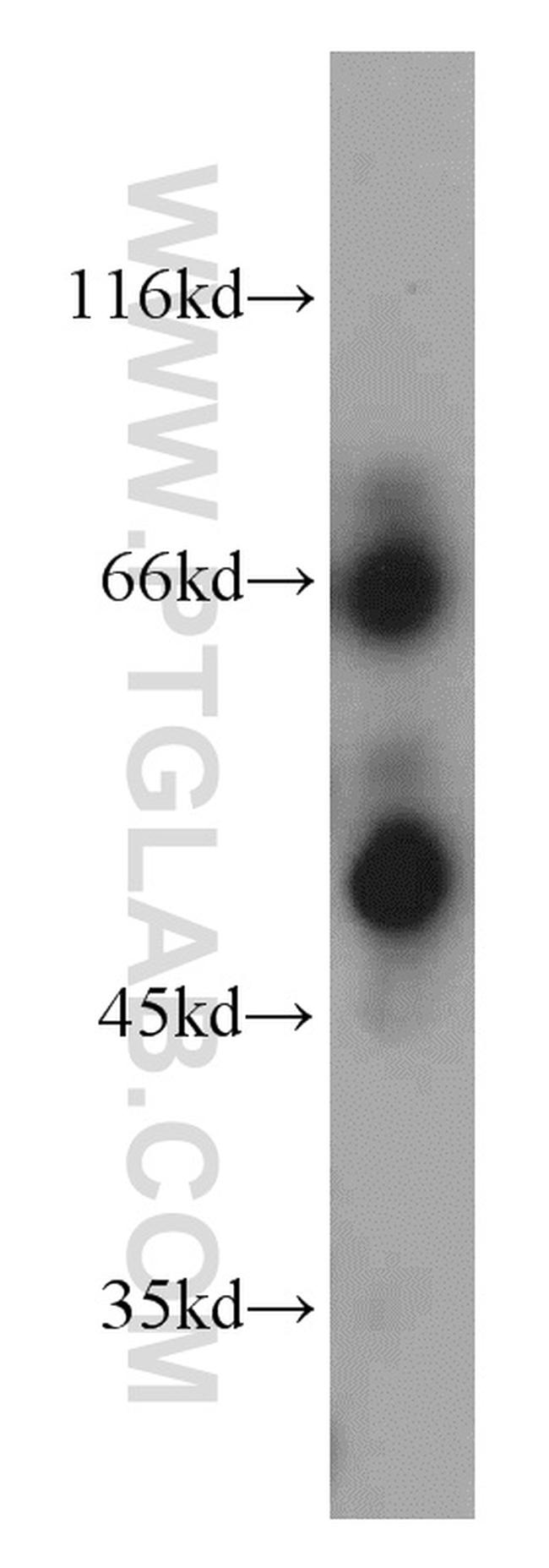 HPSE Antibody in Western Blot (WB)