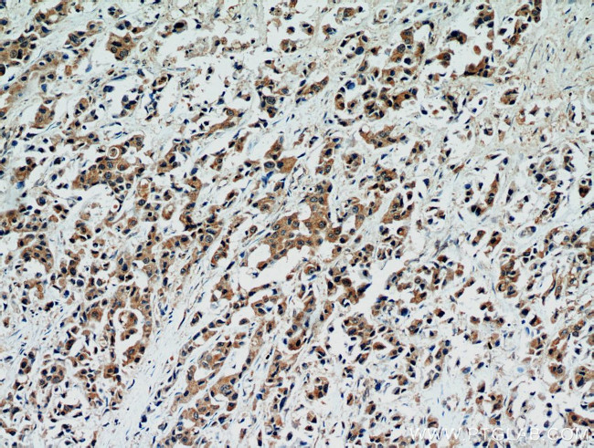 STAT2 Antibody in Immunohistochemistry (Paraffin) (IHC (P))