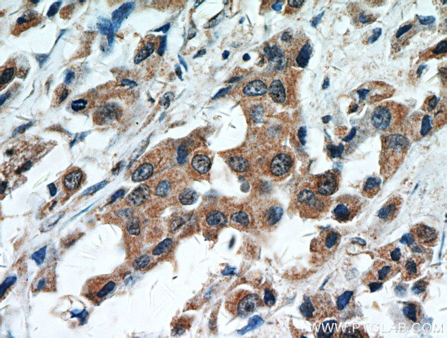 STAT2 Antibody in Immunohistochemistry (Paraffin) (IHC (P))