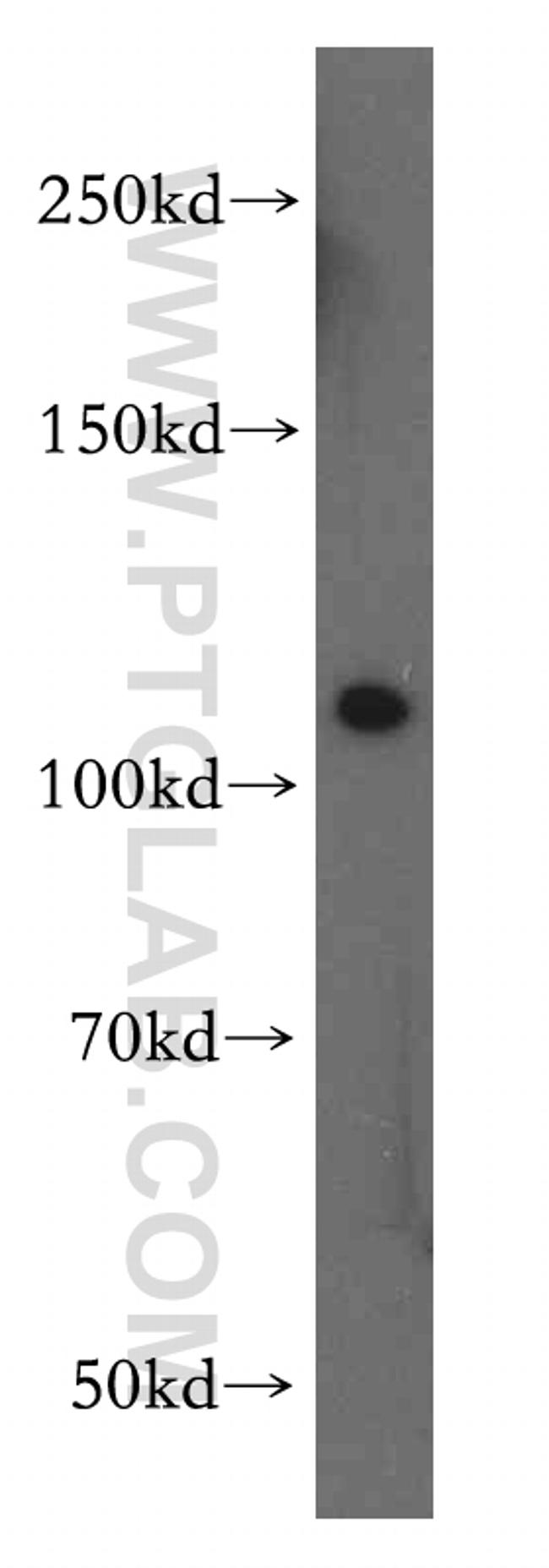 STAT2 Antibody in Western Blot (WB)