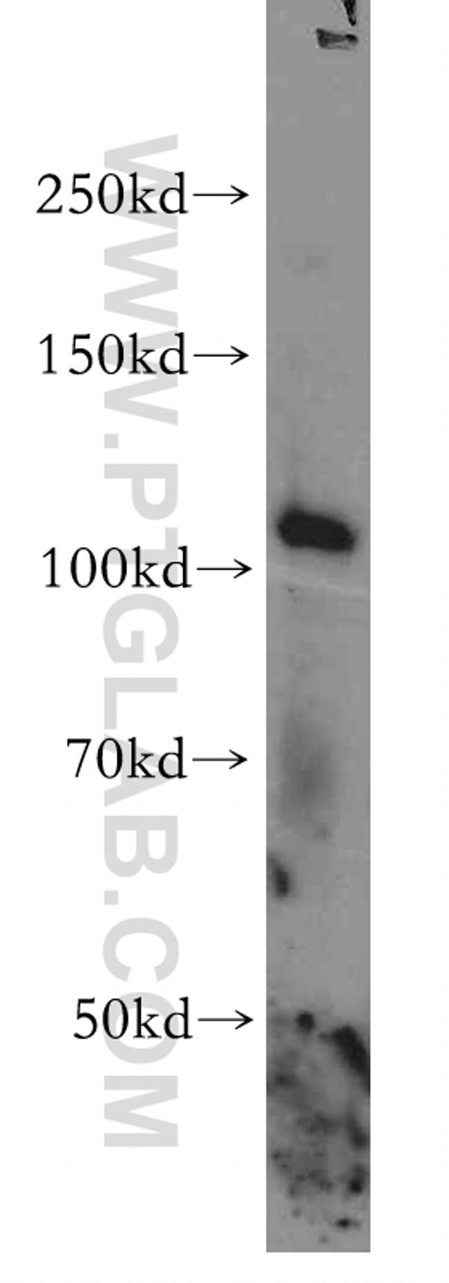 STAT2 Antibody in Western Blot (WB)