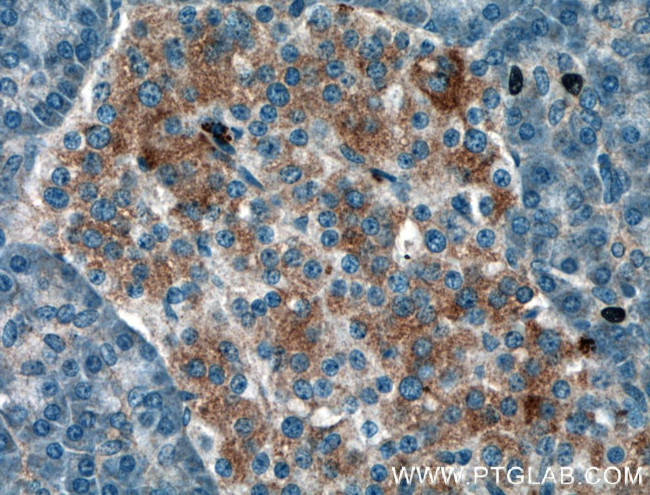 AMFR Antibody in Immunohistochemistry (Paraffin) (IHC (P))