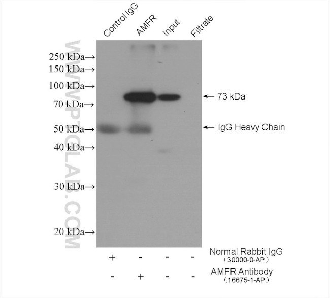 AMFR Antibody in Immunoprecipitation (IP)