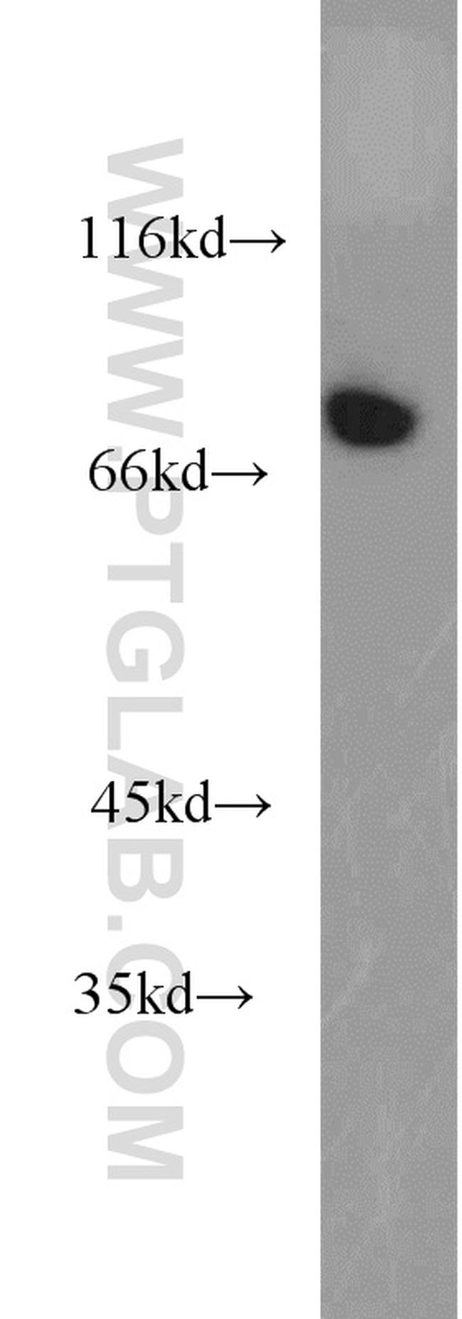 AMFR Antibody in Western Blot (WB)