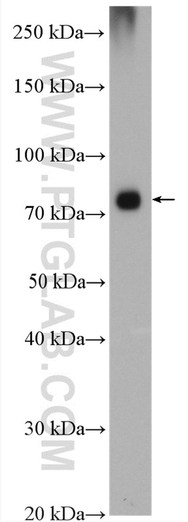 AMFR Antibody in Western Blot (WB)