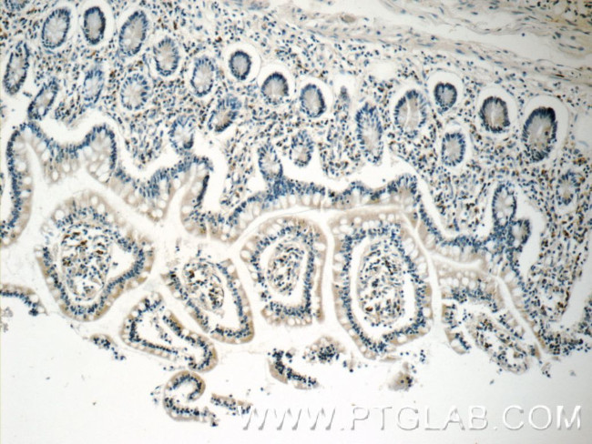 CD244 Antibody in Immunohistochemistry (Paraffin) (IHC (P))