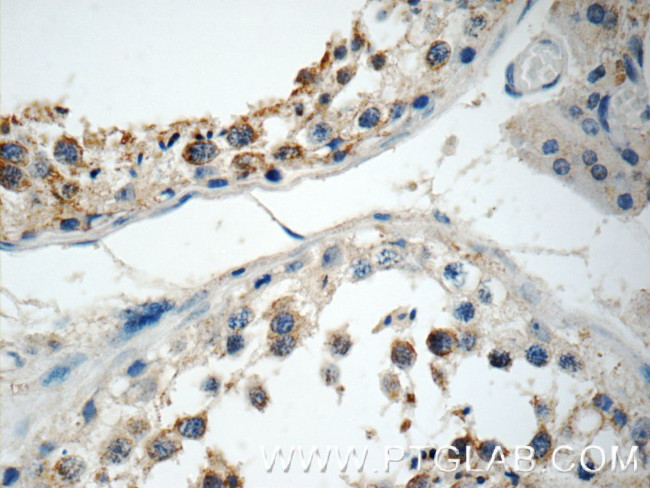 CD244 Antibody in Immunohistochemistry (Paraffin) (IHC (P))