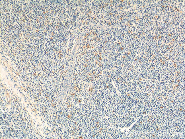 CD244 Antibody in Immunohistochemistry (Paraffin) (IHC (P))