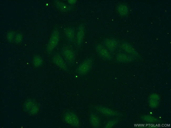 POLR1D Antibody in Immunocytochemistry (ICC/IF)