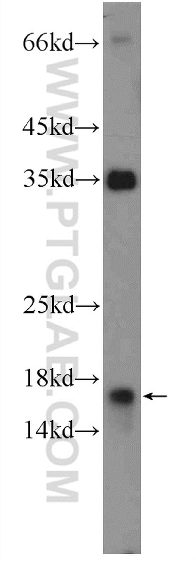 POLR1D Antibody in Western Blot (WB)