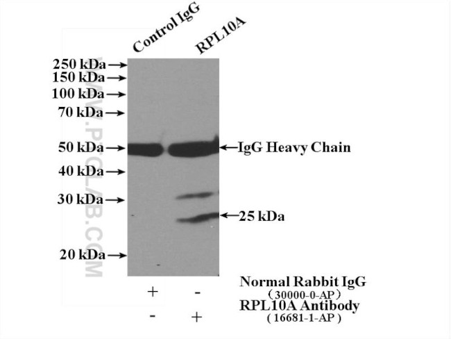 RPL10A Antibody in Immunoprecipitation (IP)