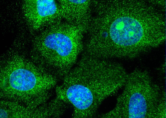 RPS14 Antibody in Immunocytochemistry (ICC/IF)