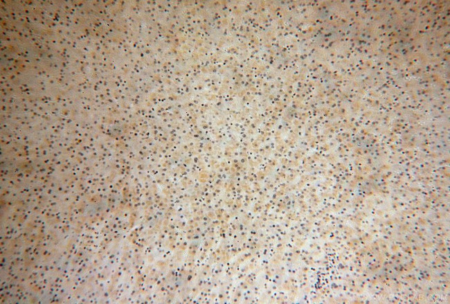 RPS14 Antibody in Immunohistochemistry (Paraffin) (IHC (P))