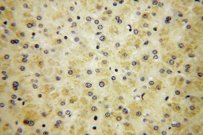 RPS14 Antibody in Immunohistochemistry (Paraffin) (IHC (P))