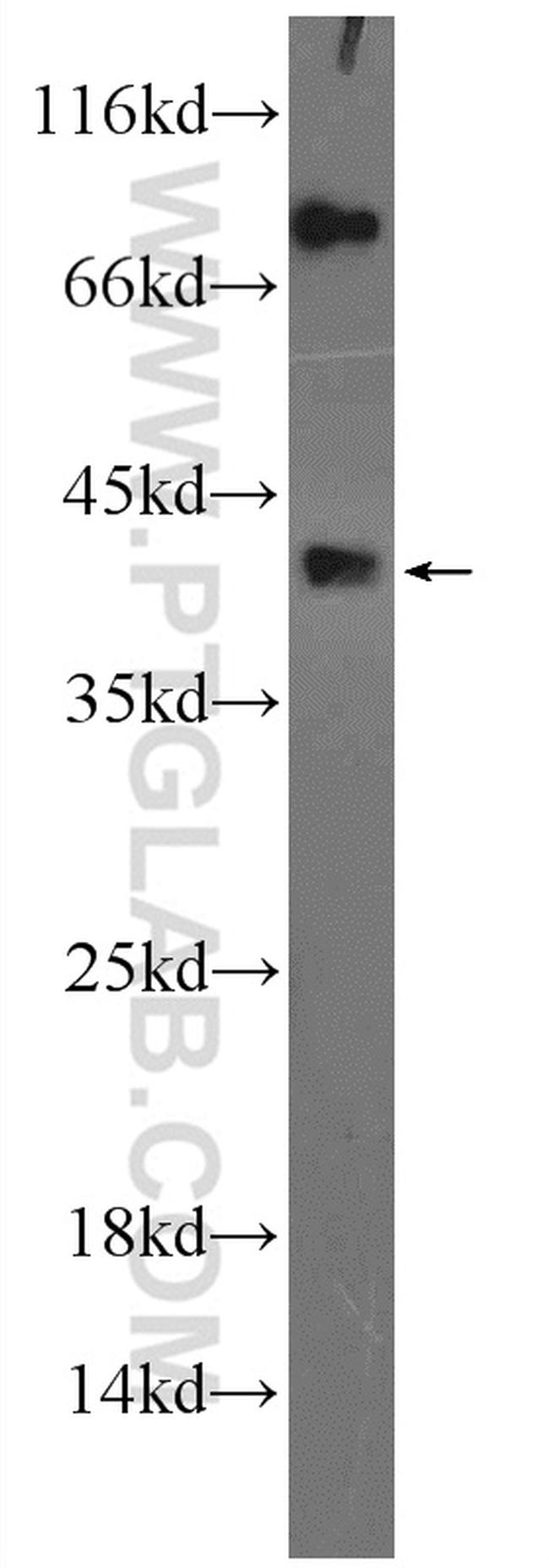 DCTPP1 Antibody in Western Blot (WB)