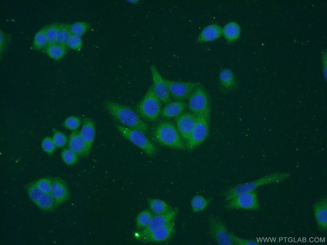 DCTPP1 Antibody in Immunocytochemistry (ICC/IF)