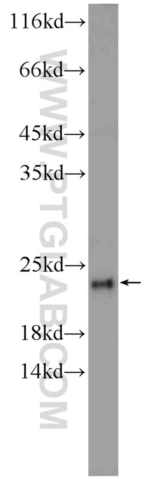 DCTPP1 Antibody in Western Blot (WB)