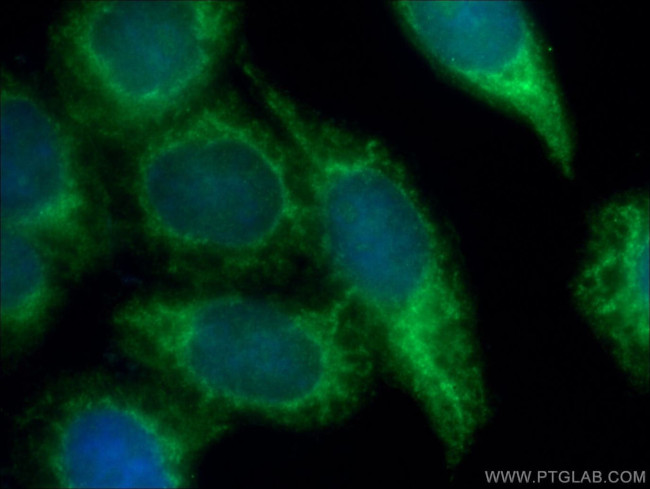 CRK Antibody in Immunocytochemistry (ICC/IF)