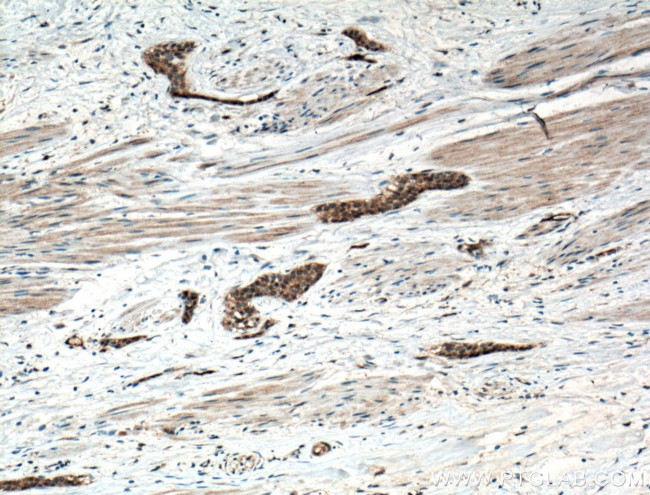 CRK Antibody in Immunohistochemistry (Paraffin) (IHC (P))