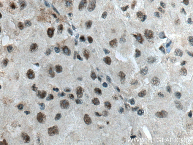 ALY Antibody in Immunohistochemistry (Paraffin) (IHC (P))