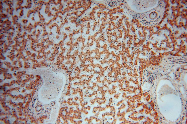 PARP11 Antibody in Immunohistochemistry (Paraffin) (IHC (P))