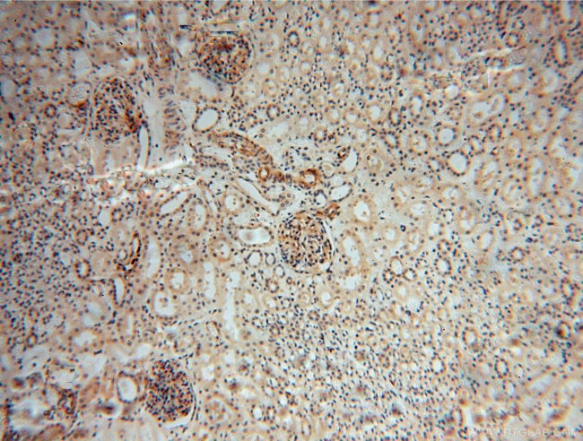 PARP11 Antibody in Immunohistochemistry (Paraffin) (IHC (P))