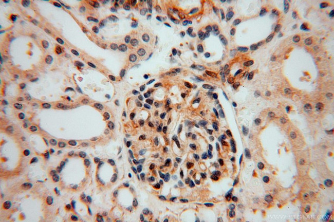 PARP11 Antibody in Immunohistochemistry (Paraffin) (IHC (P))