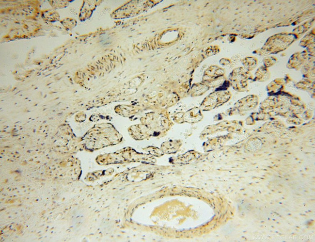 PARP11 Antibody in Immunohistochemistry (Paraffin) (IHC (P))