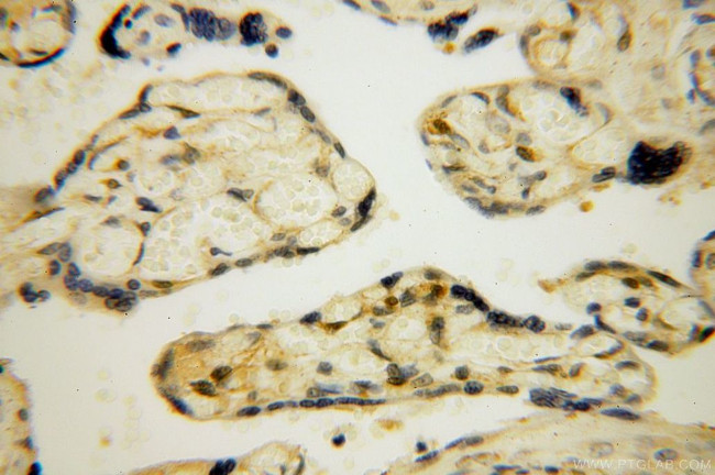 PARP11 Antibody in Immunohistochemistry (Paraffin) (IHC (P))