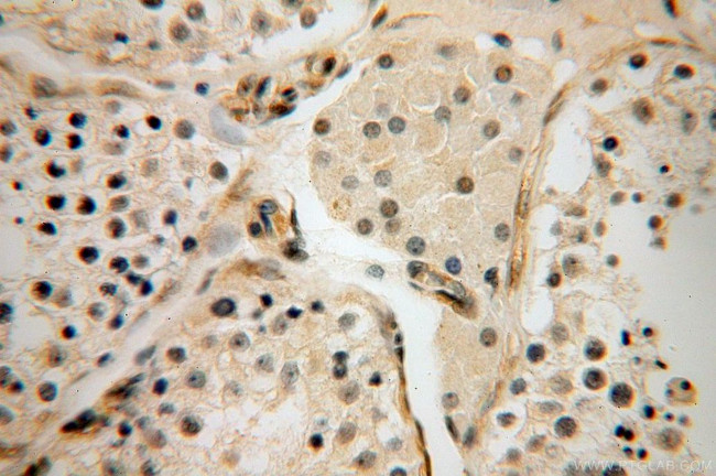 PARP11 Antibody in Immunohistochemistry (Paraffin) (IHC (P))