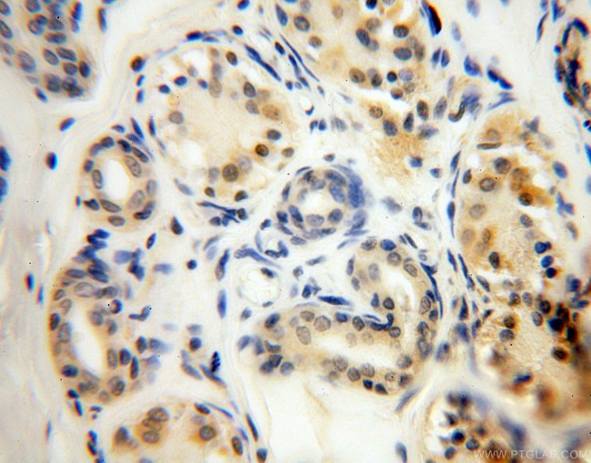 PARP11 Antibody in Immunohistochemistry (Paraffin) (IHC (P))