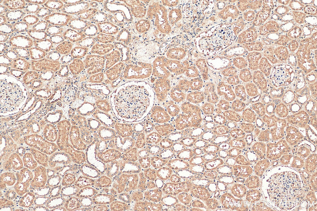 PARP11 Antibody in Immunohistochemistry (Paraffin) (IHC (P))