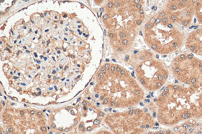 PARP11 Antibody in Immunohistochemistry (Paraffin) (IHC (P))