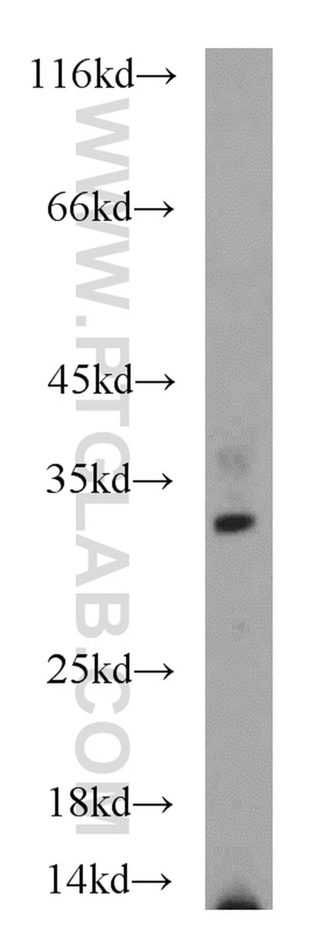 PARP11 Antibody in Western Blot (WB)