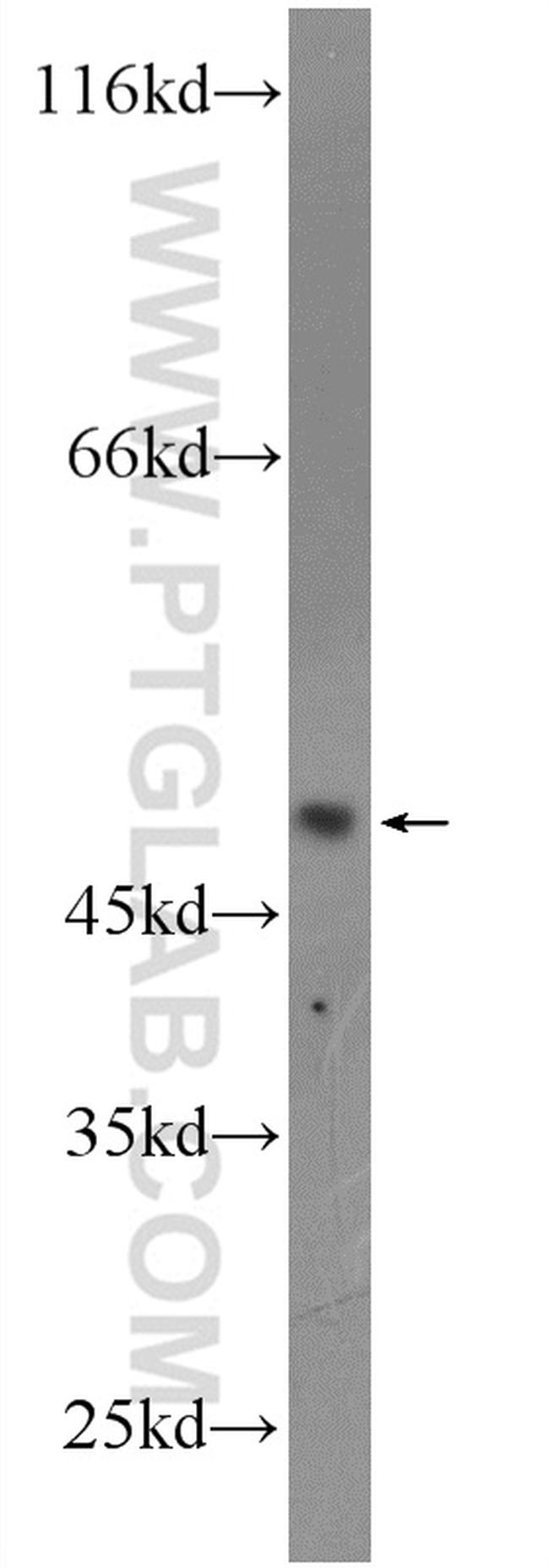 MTRF1L Antibody in Western Blot (WB)