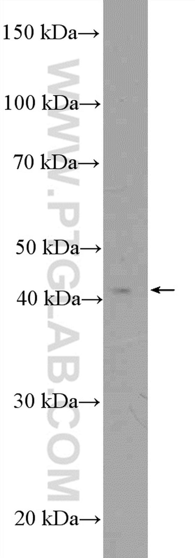 MTRF1L Antibody in Western Blot (WB)