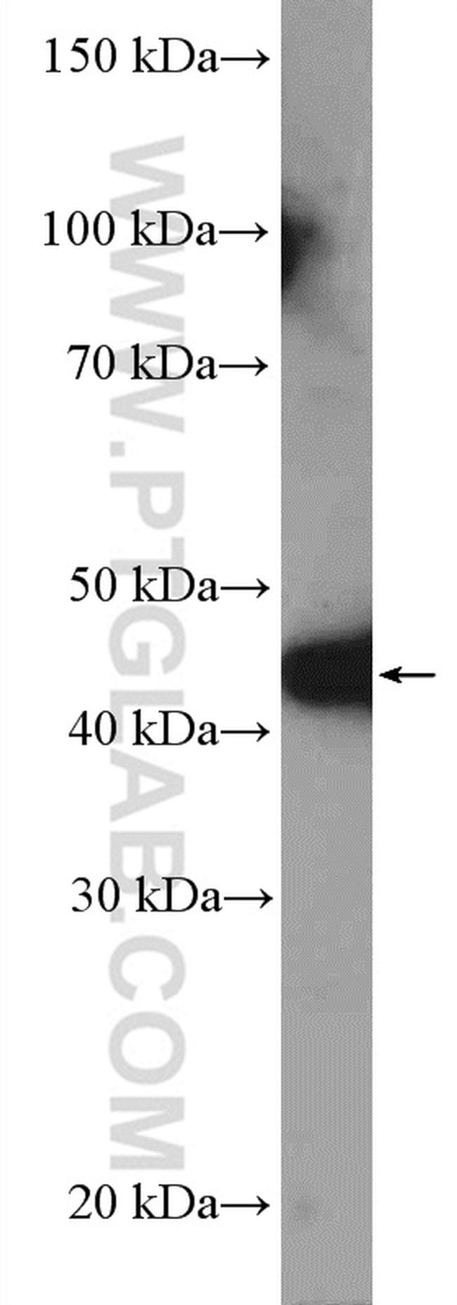 MTRF1L Antibody in Western Blot (WB)