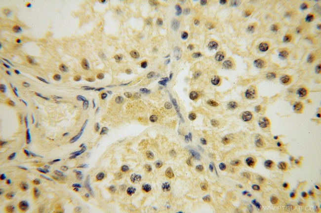 ARHGAP4 Antibody in Immunohistochemistry (Paraffin) (IHC (P))