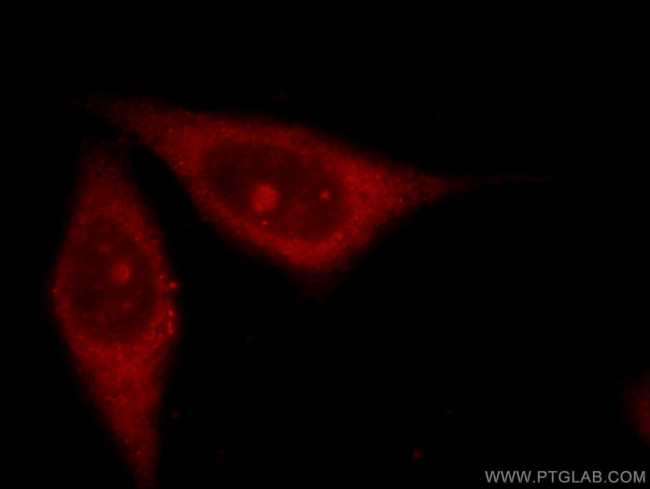 ARHGAP4 Antibody in Immunocytochemistry (ICC/IF)